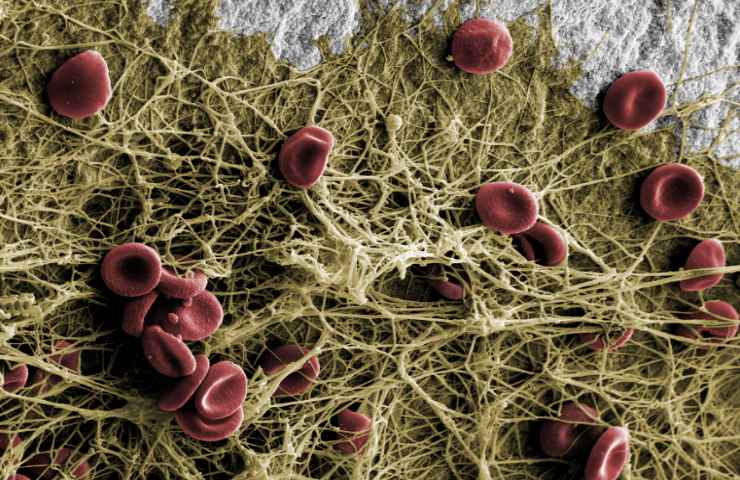 Only a few minutes after insertion, a fibrin network forms on the implant surface with a roughness of 6 μm, which accelerates contact osteogenesis and
particularly optimises the early stages of healing.